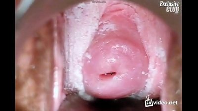 Su'esu'ega gynecological o se fafine lalelei